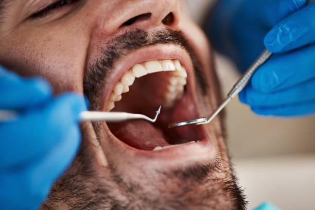 Best After-Hours Dental Trauma Care in New Bremen, OH
